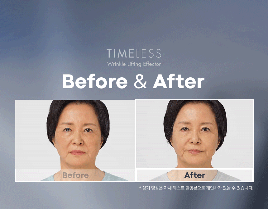 timeless wrinkle lifting effector detail